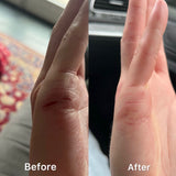 Eczema - Oat Cream